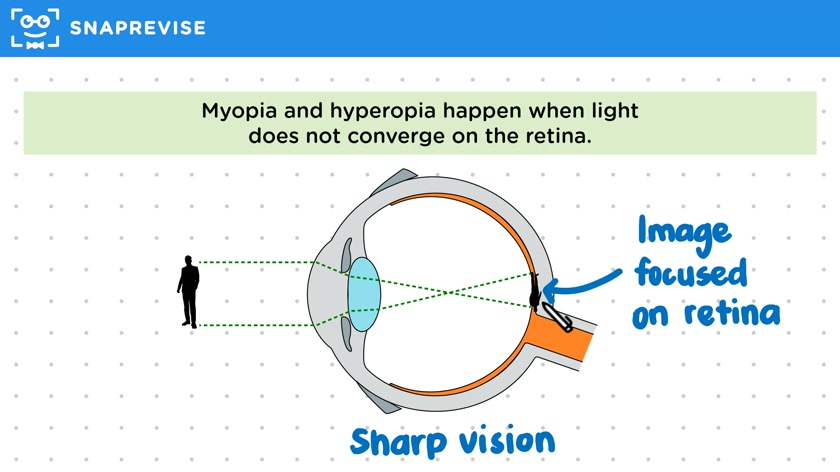 Myopia & Hyperopia