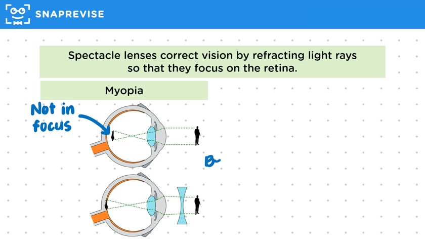 Correcting Eyesight