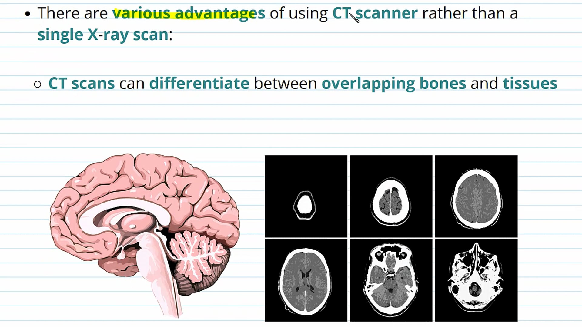 Advantages and Disadvantages of CT Scanning