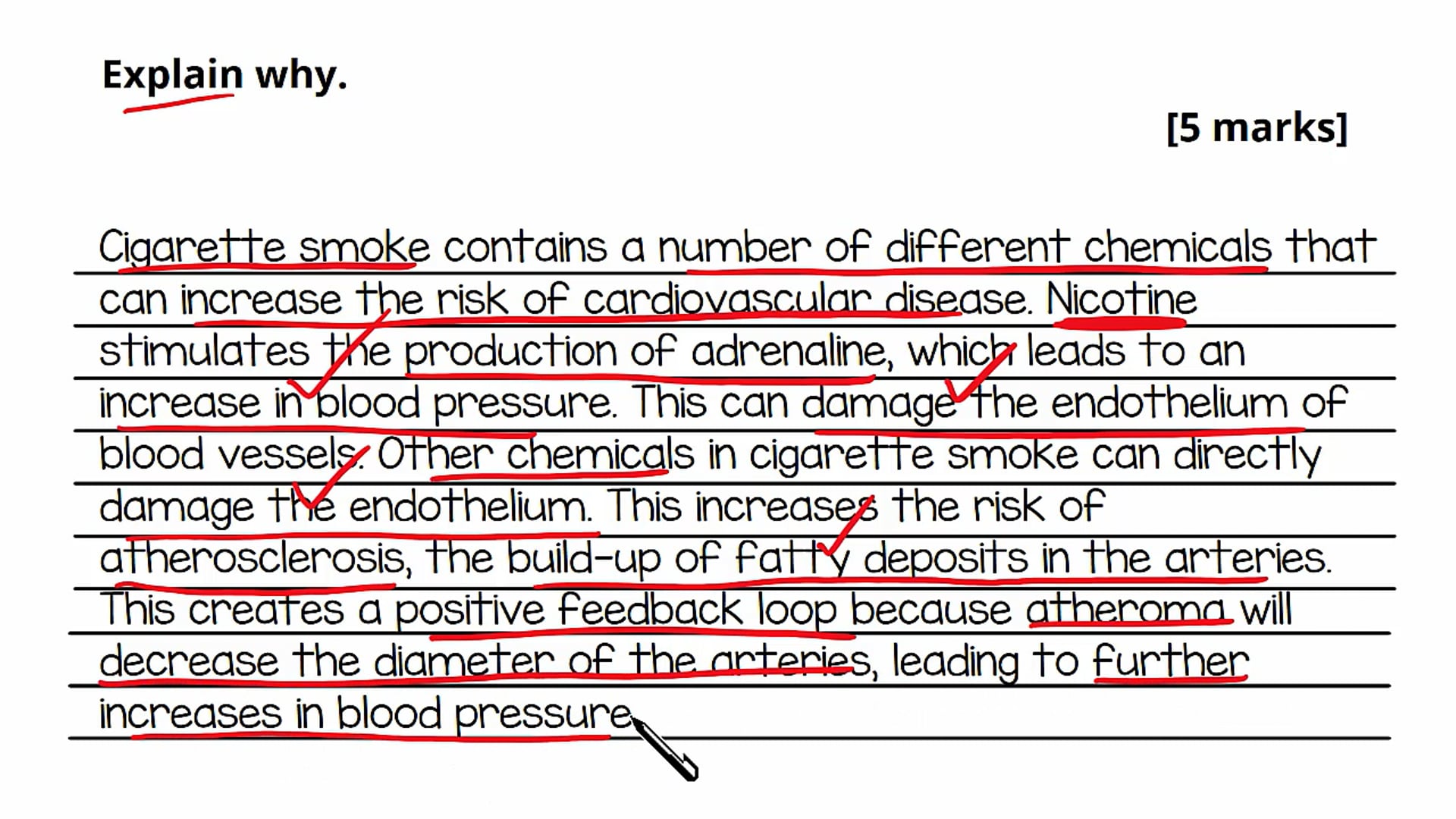 Cardiovascular Disease Exam Question