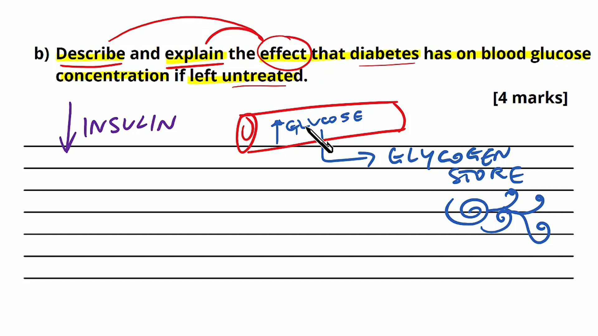 Diabetes Exam Question