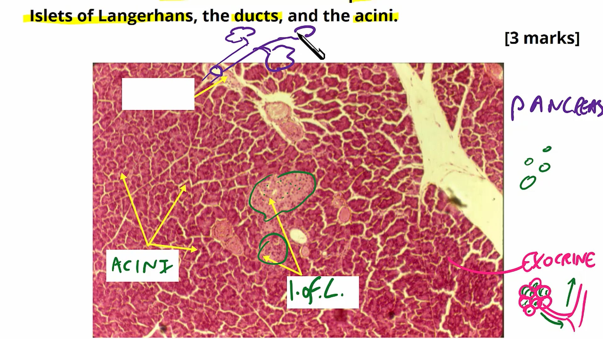 The Pancreas and Insulin Exam Questions