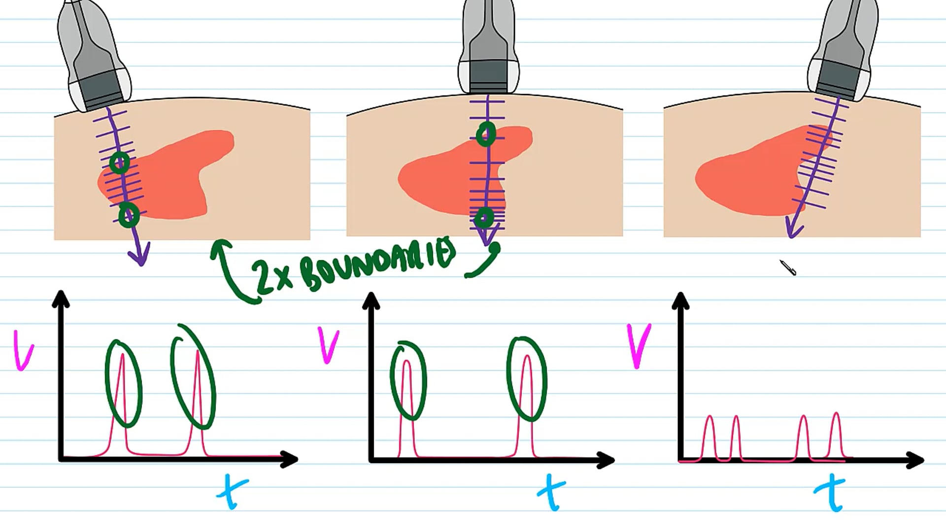 The Use of Ultrasound B-scans