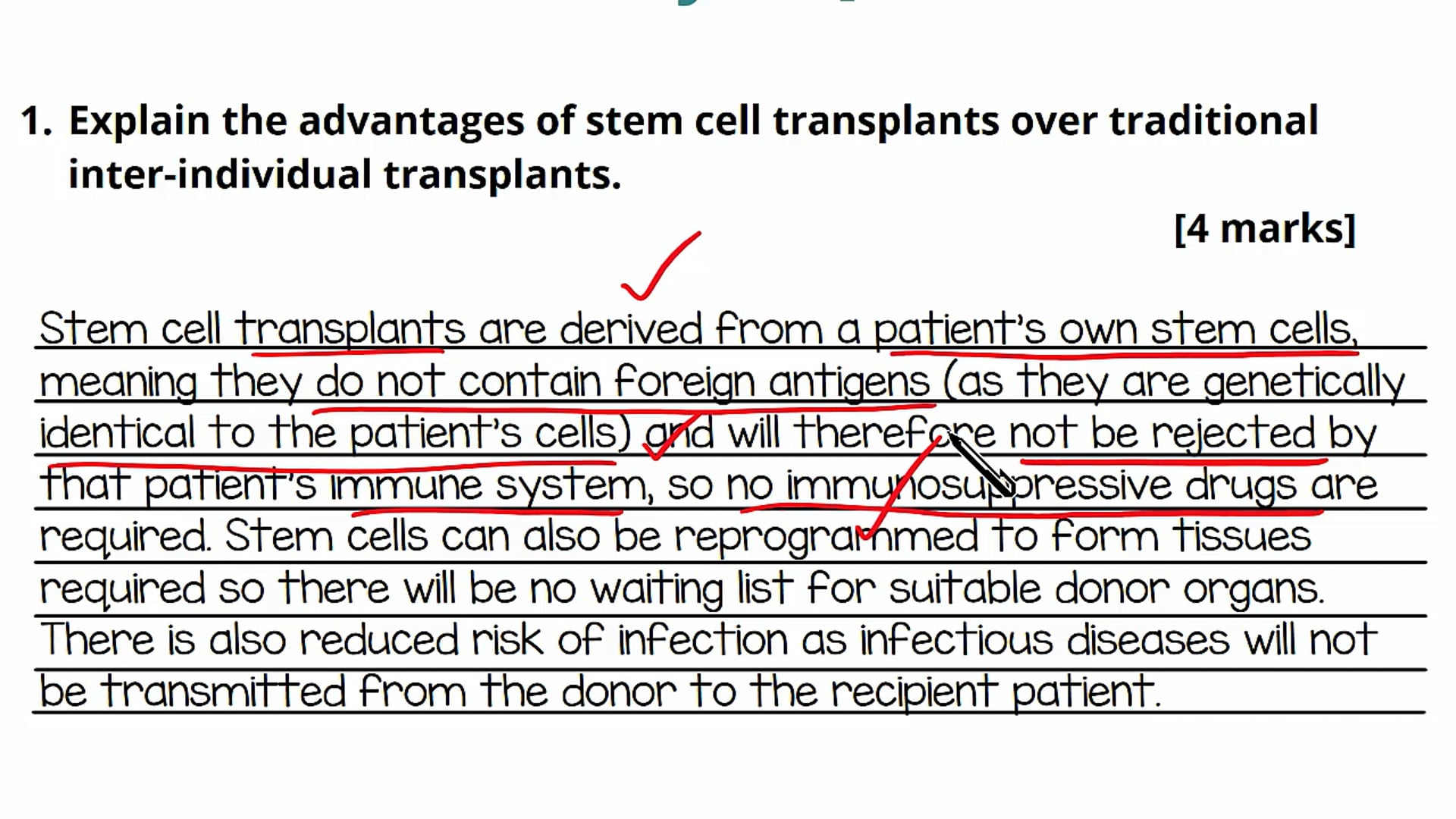 Using Stem Cells Exam Question